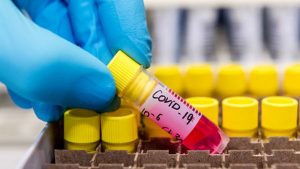 Ghana records 9 another COVID-19 cases, total now 214