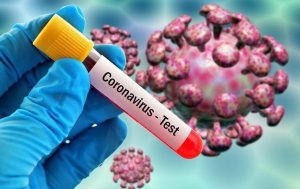 COVID-19: 30 Health Workers Test Positive In Ashanti Region