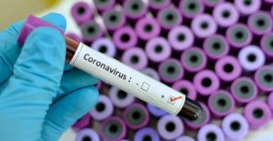 COVID-19: All patients at Korle Bu Teaching Hospital treated and discharged