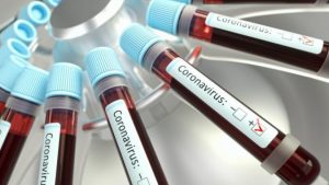 Five staff of Multimedia Group test positive for Covid-19