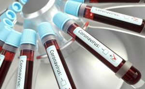 COVID-19: Ghana Health Service Publishes Details Of Deceased Persons
