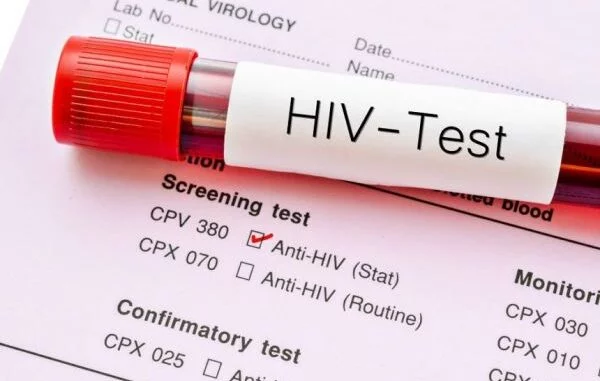Ghana AIDS Commission CRIES Over Few Number of Persons Living With HIV/AIDS On Medication Out of 345,534 Positive Recorded 2 Ghana AIDS Commission CRIES Over Few Number of Persons Living With HIV/AIDS On Medication Out of 345,534 Positive Recorded