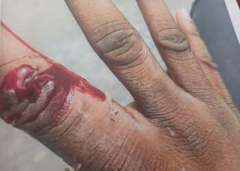 Driver jailed for biting police officer’s fingers