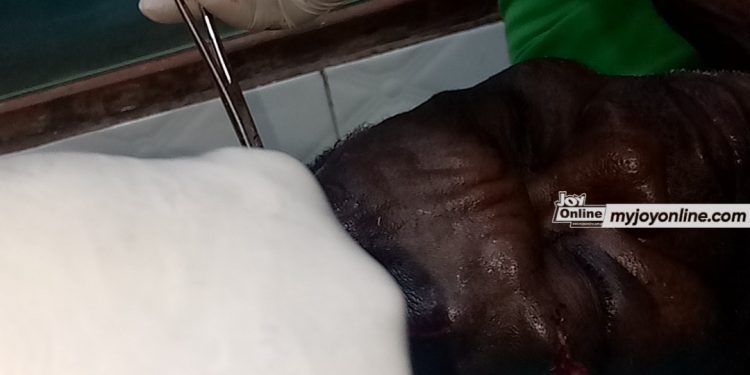 man 47 inflicts cutlass wounds on friend over roofing sheet
