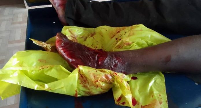 tragedy in kadjebi as falling tree kills chainsaw operator