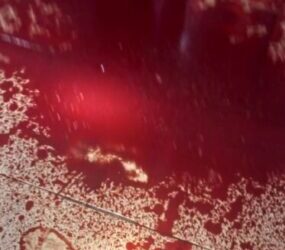 Jilted lover inflicts cutlass wounds on girlfriend