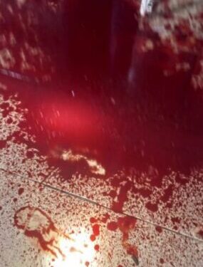 Jilted lover inflicts cutlass wounds on girlfriend 1 jilted lover inflicts cutlass wounds on girlfriend