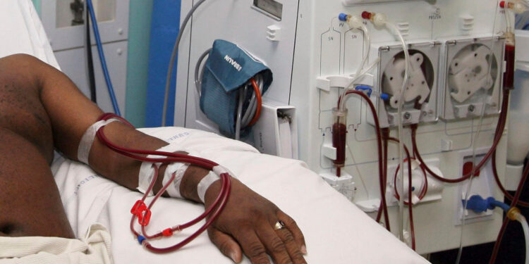 government considering including dialysis treatment on nhis health ministry