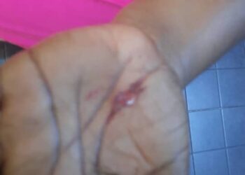 Man allegedly attacks estranged wife in an attempt to take custody of their children