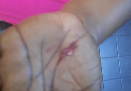 Man allegedly attacks estranged wife in an attempt to take custody of their children 1 man allegedly attacks estranged wife in an attempt to take custody of their children