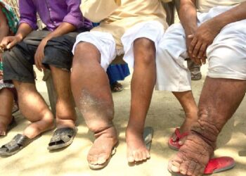 Patients’ beliefs about illness matter: the case of elephantiasis in rural Ghana