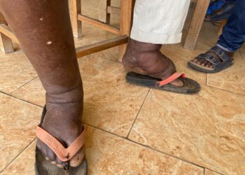 Sekyere East District Health Directorate appeals for public support in battle against NTDs