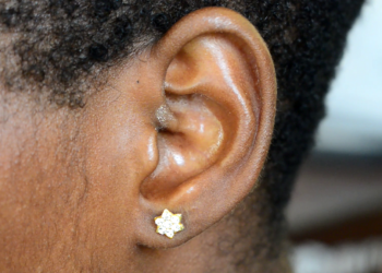 24-year-old with vision and hearing impairments appeals for support to procure a pair of hearing aids