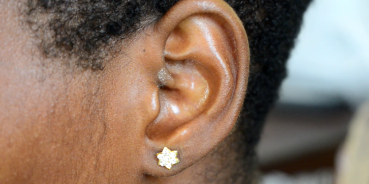24 year old with vision and hearing impairments appeals for support to procure a pair of hearing aids