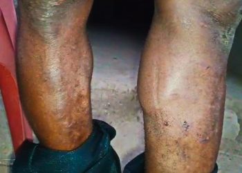 Assemblyman alleges kidnap, torture on orders of NDC Bono East regional chairman