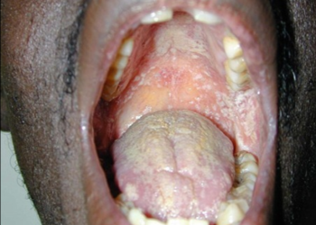 Kwesi Yankah: O.R.A.L. cavities