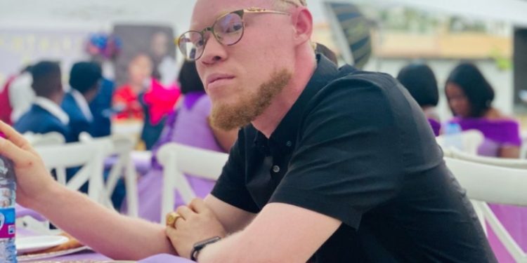 ill be hurt if i dont give birth to a child like me albino explains