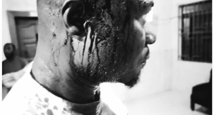 4 land guards remanded for violent activities in millennium city