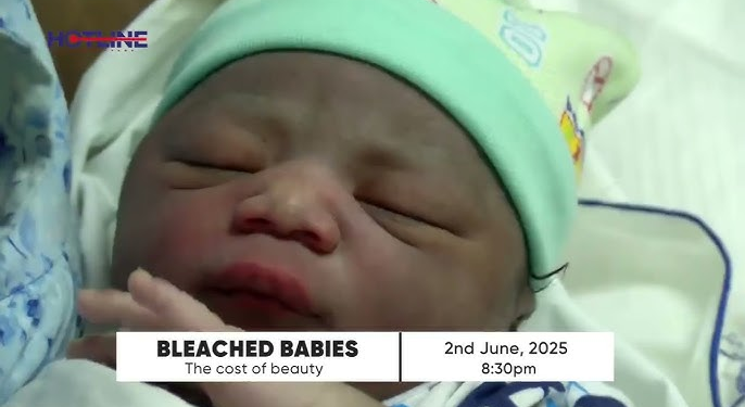 bleached children may have brain challenge other health complications dr titus beyuo