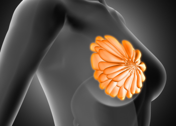 KNUST researchers develop AI model to enhance breast cancer diagnosis