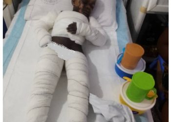 Mother and children suffer severe burns, appeal for support for life-saving treatment