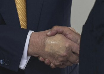 White House says Trump diagnosed with vein condition after questions about bruises