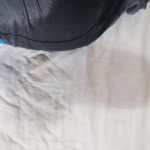 Bedwetting: Seven‑year‑old burned; guardian faces charges 1 bedwetting seven year old burned guardian faces charges