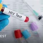 Berekum West rank 10th in HIV/AIDS cases 
