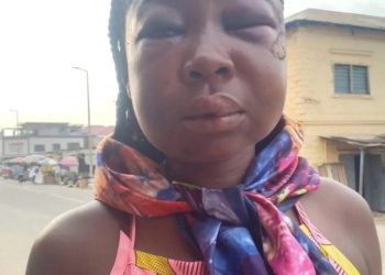 ₵50 fee dispute turns violent as sex worker is assaulted by client in Sekondi
