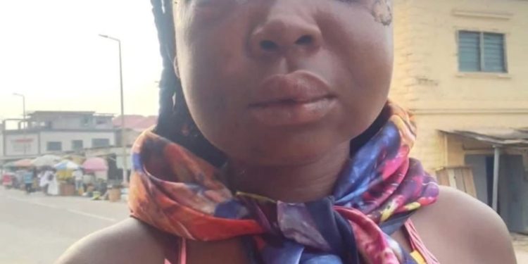 e282b550 fee dispute turns violent as sex worker is assaulted by client in sekondi