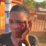 Police rescue young woman, arrest partner in viral domestic abuse case 4 Police rescue young woman, arrest partner in viral domestic abuse case