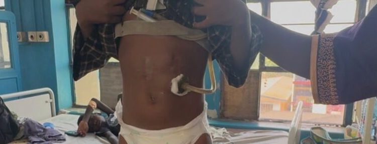 haruna iddrisu funds fourth life saving surgery for six year old at kath