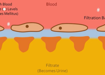Hypertension rates rising in Ghana as many remain unaware of the condition