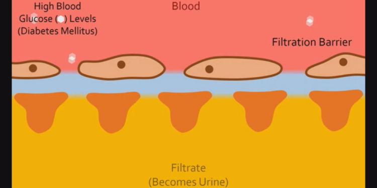 Hypertension rates rising in Ghana as many remain unaware of the condition 1 hypertension rates rising in ghana as many remain unaware of the condition