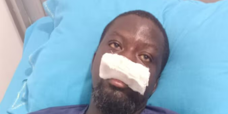 renowned artist ibrahim mahama assaulted by police in tamale